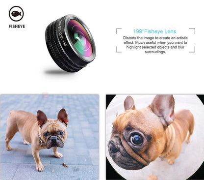 Shutterstream – 10-in-1 Cellphone Camera Lens Kit